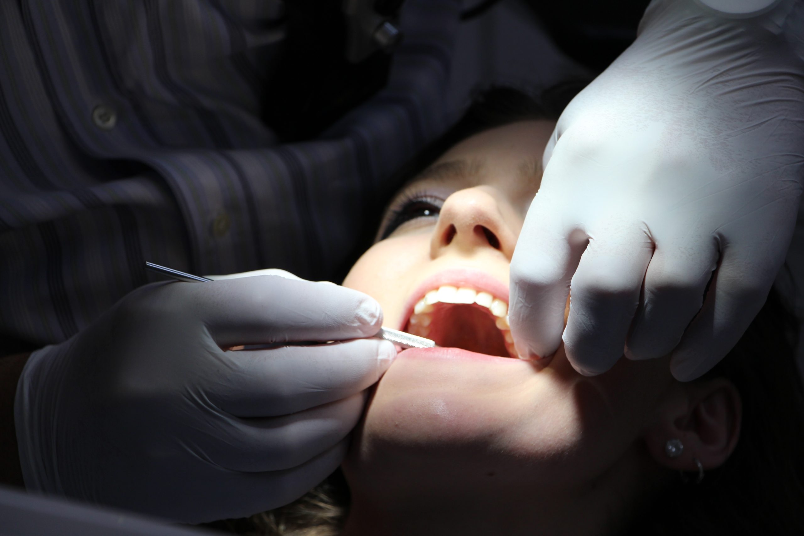 woman at the dentist with mouth open